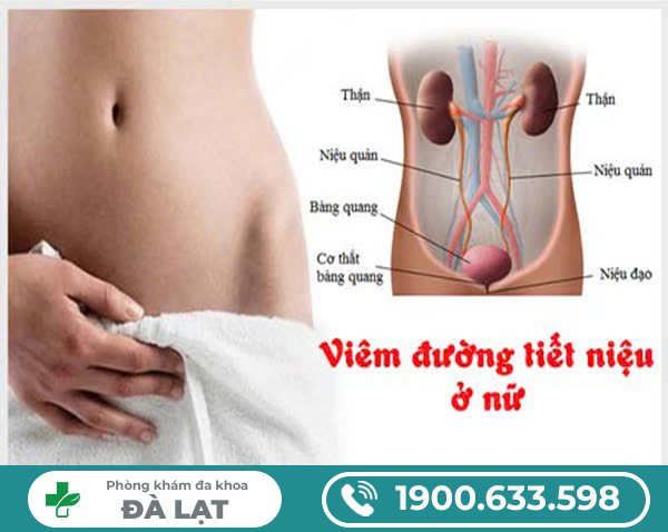 Hình ảnh minh họa